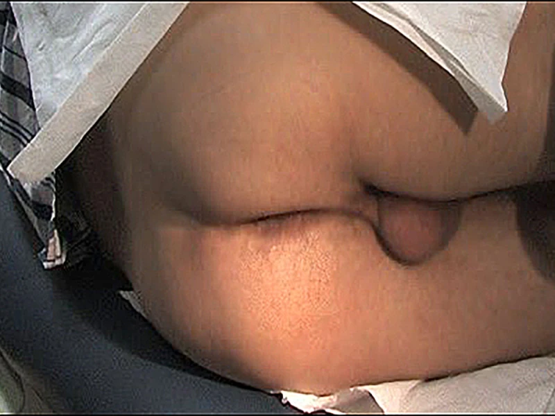 Anorectal examination